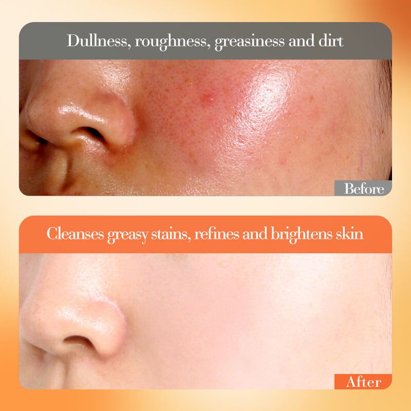 FAYANKÔU – Coffret visage Vitamine C | Éclat & hydratation (Kit 6 pièces) – Image 4