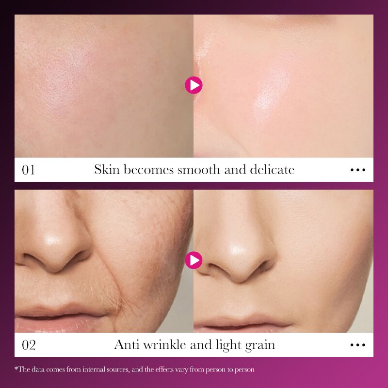 SADOER – Coffret visage Collagène d’Escargot | Hydratation & réparation (Kit 6 pièces) – Image 4