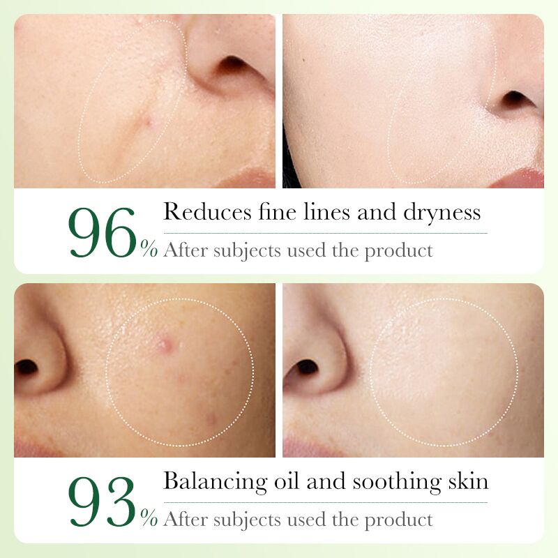 ZOZU – Coffret visage Huile d’Olive Antioxidant | Hydratation & nutrition (Kit 6 pièces) – Image 4